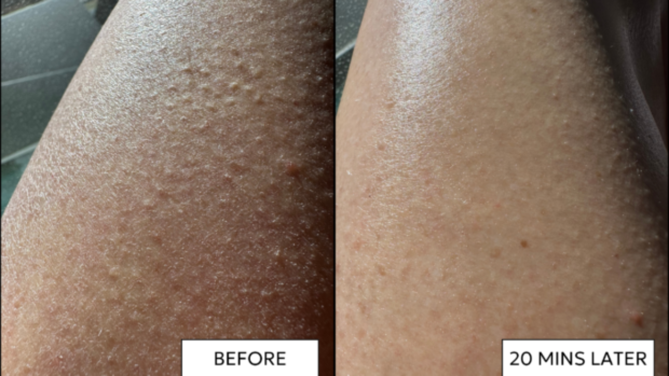 Leg-Facial-new-620x400.png